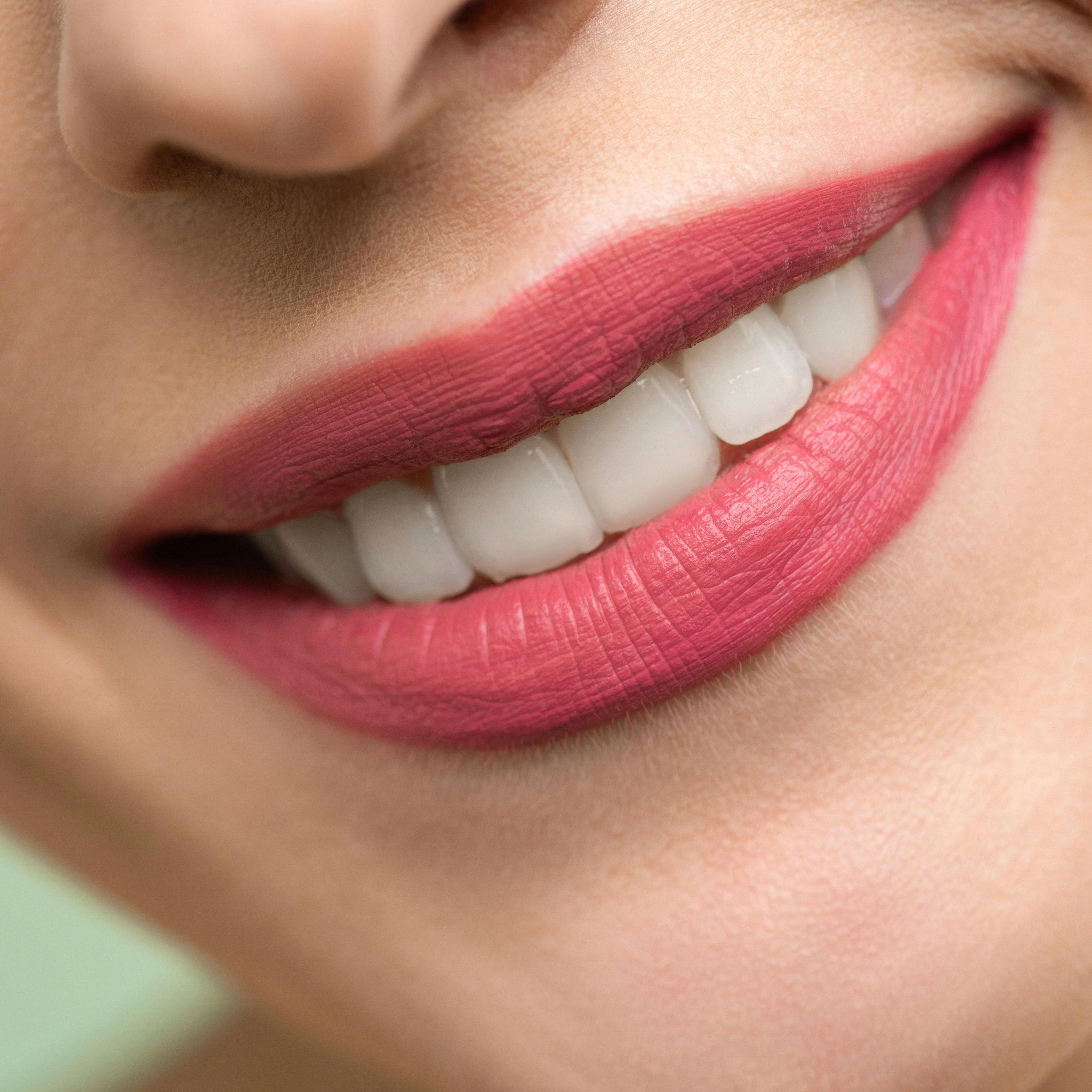 Patient with traditional metal braces showing a confident smile